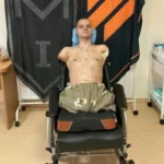 Приватбанк відмовився видати картку військовому з ампутаціями: деталі скандалу