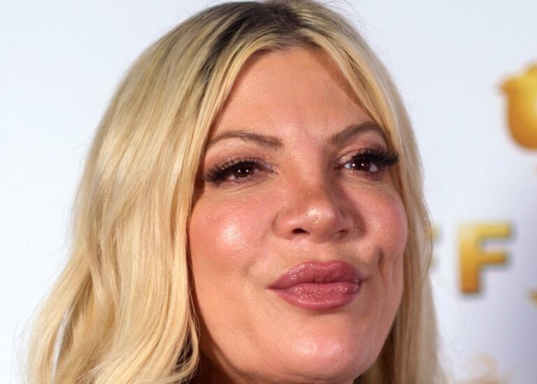 Зірка Беверлі-Гіллз стала жертвою моторошної ДТП